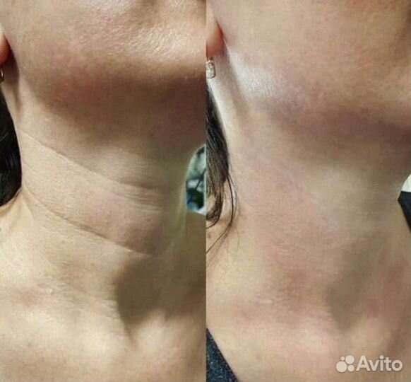 Услуги косметолога