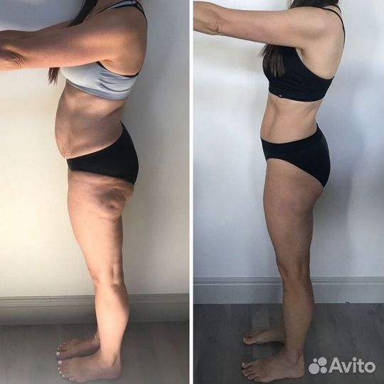 Антицеллюлитный Лимфодренажный массаж Обертывания