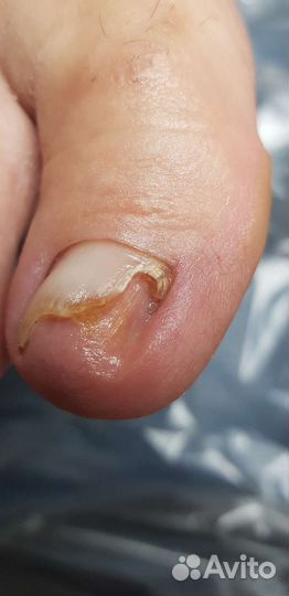 Подолог, педикюр, маникюр