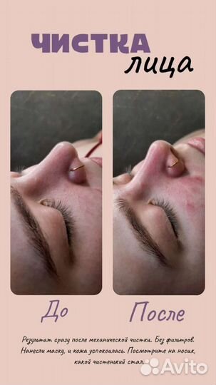 Косметолог чистка лица депиляция