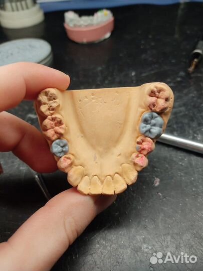 Зуботехнические услуги