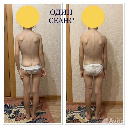 Инструктор лфк. Коррекция осанки