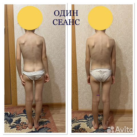 Инструктор лфк. Коррекция осанки