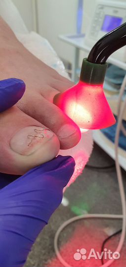 Аппаратный педикюр