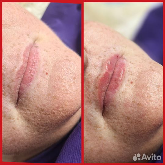 Услуги косметолога