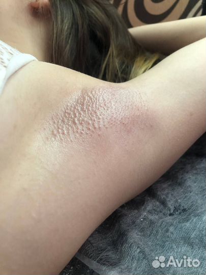 Шугаринг Воск Депиляция Обучение