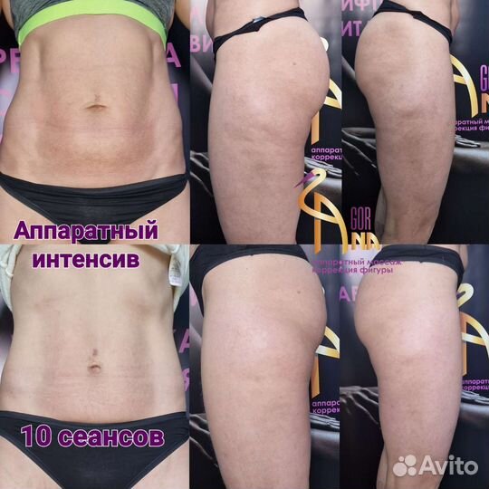 Массаж, коррекция фигуры, кавитация, вакуумный