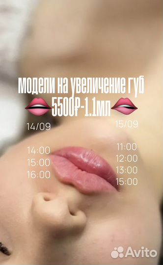Модель на увеличение губ