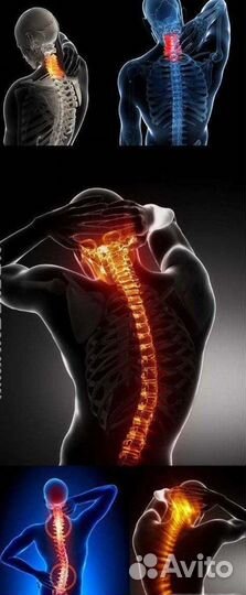 Костоправ Без Боли