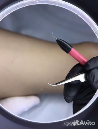 Электроэпиляция Нежинка Пригородный