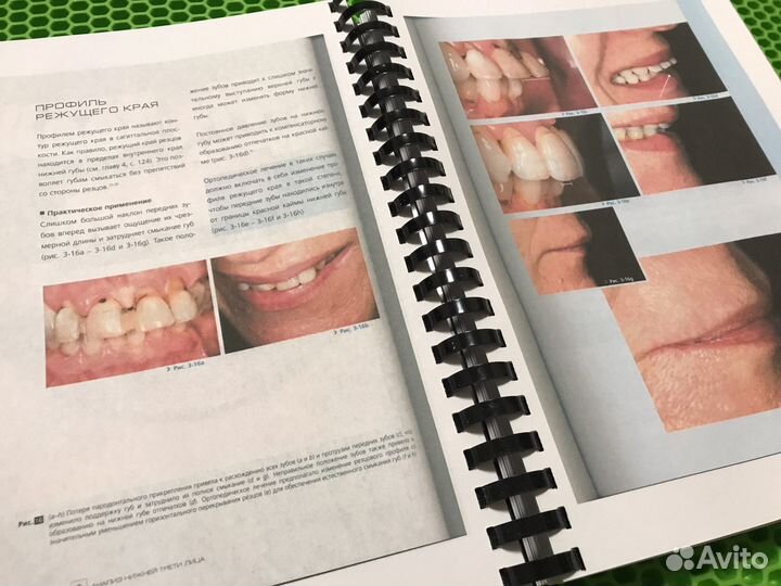 Анализ эстетики Фрадеани Том 1