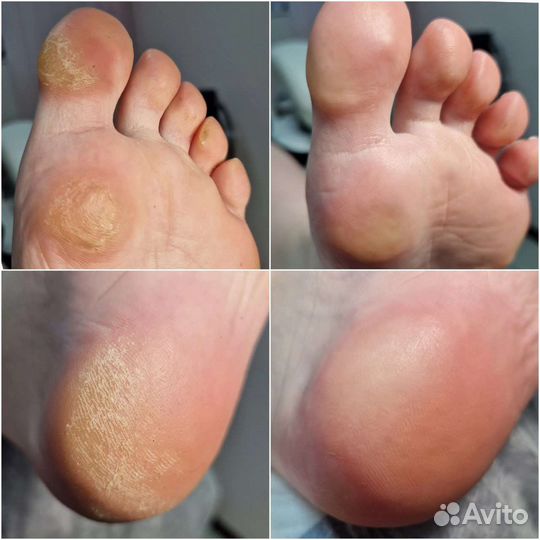 Маникюр Педикюр любой сложности Подолог