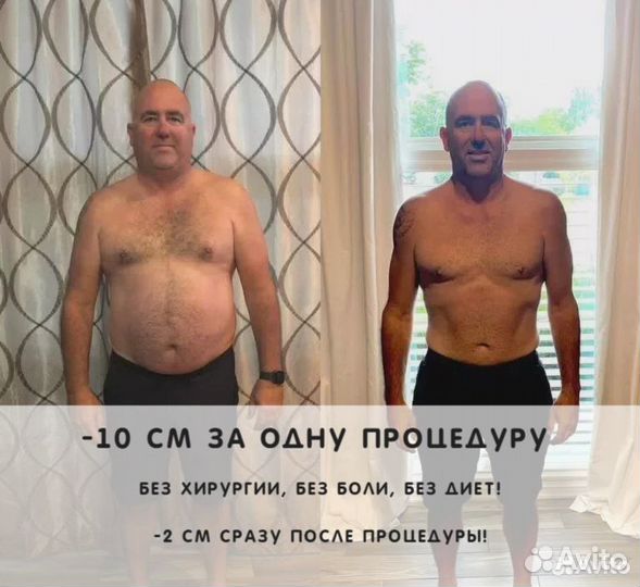 Моментальное похудение за 1 сеанс. Эффект сразу