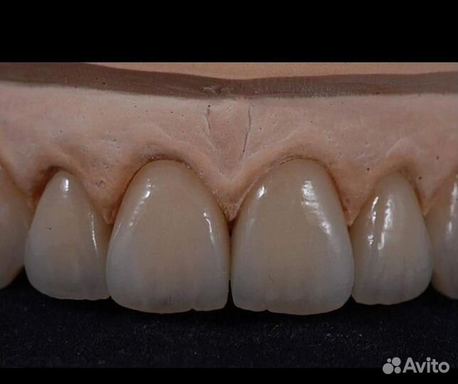 Зубной техник Изготовление Циркон Сотрудничество