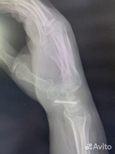 Ренген на дому