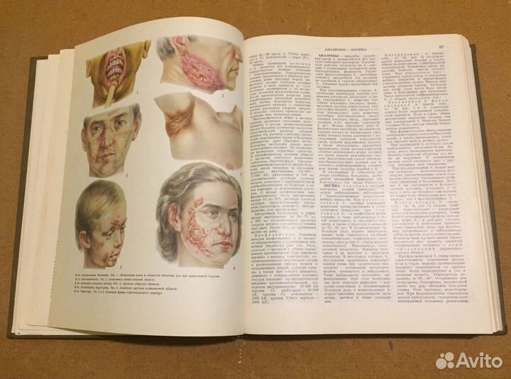 Краткая медицинская энциклопедия (том 1)