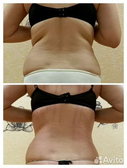 Антицеллюлитный, фитобочка, аппаратный