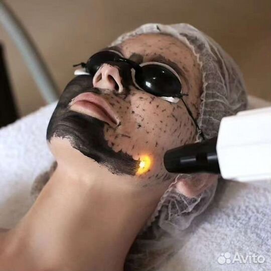 Карбоновый пилинг