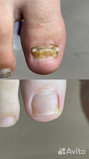 Модели на медицинский педикюр