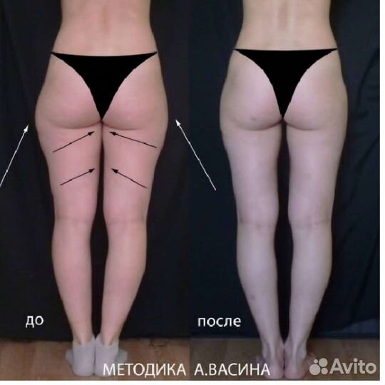 Нехирургическая (Ручная) коррекция лица и тела