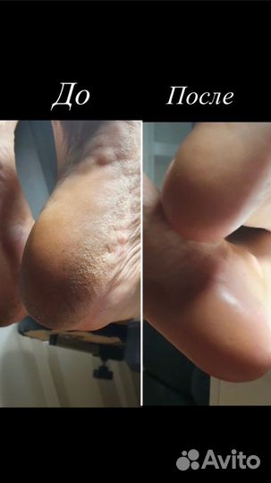 Маникюр,педикюр,наращивание на дому