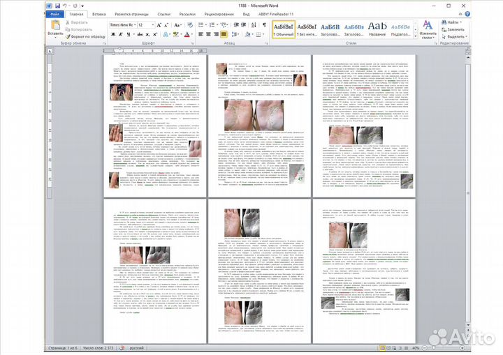 Консультация, хиромантия, коррекция, хиромант