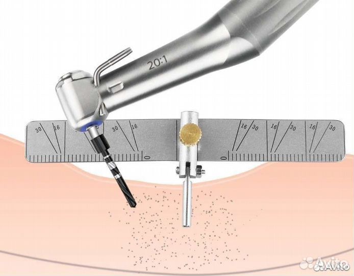 Шаблон хирургический