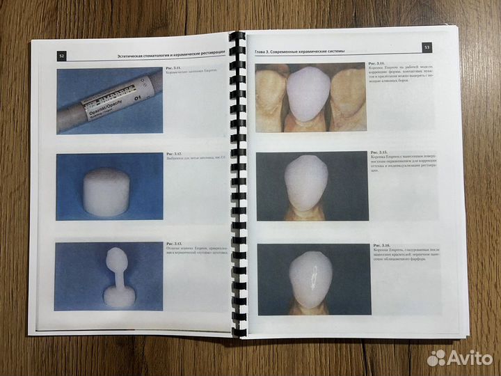 Эстетическая стоматология