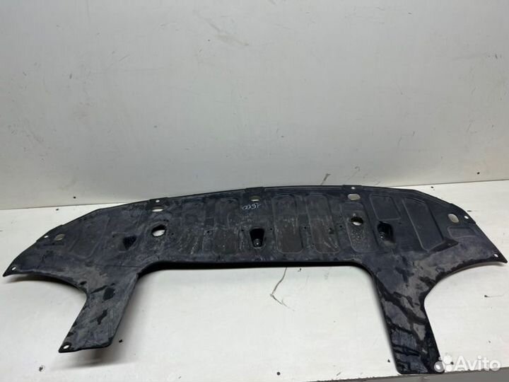 Защита бампера (пыльник) передняя Kia Rio X-Line 4