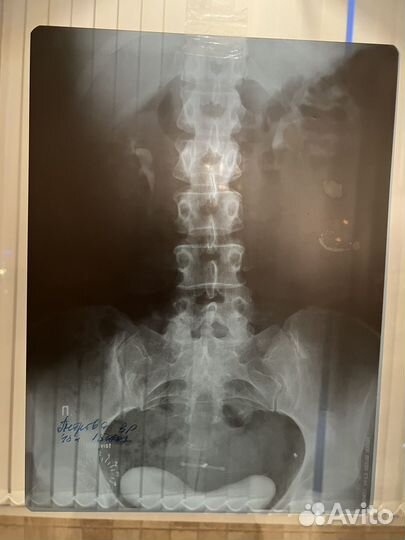 Рентгеновские снимки. 16 штук