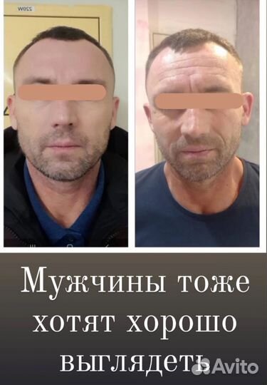 Косметолог, шугаринг