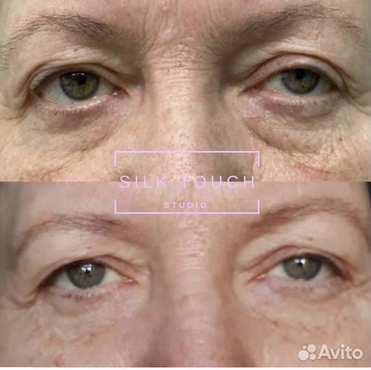 Обучение холодная плазма