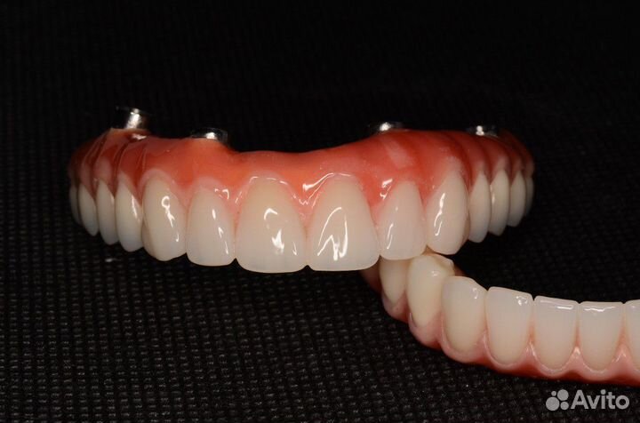 Зубной техник All-on-4