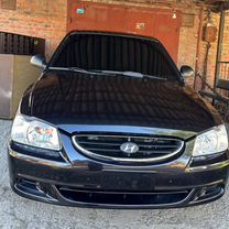 Купить Hyundai Accent 🚘 от 170 000 ₽ в Кущевской: 1 302