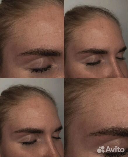 Brows