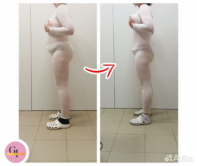 Аппаратный массаж