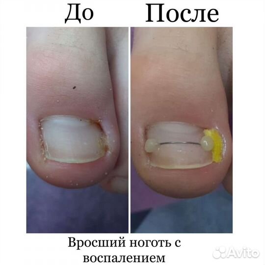 Услуги подолога