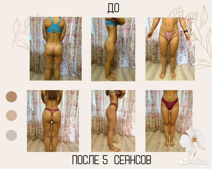 Модели на Антицеллюлитный массаж. Коррекция фигуры