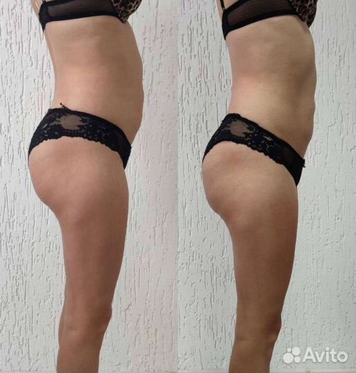 Модель на аппаратный массаж