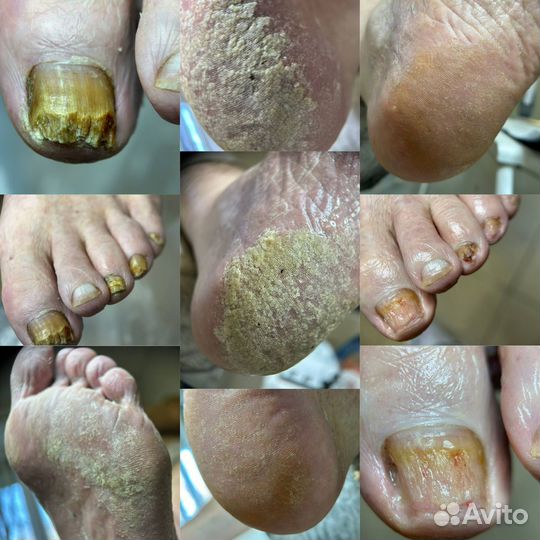 Курс подологии