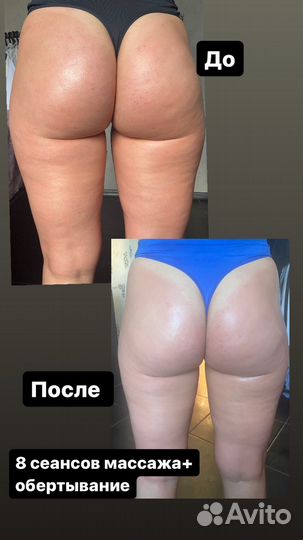 Массаж на дому Только Женщинам