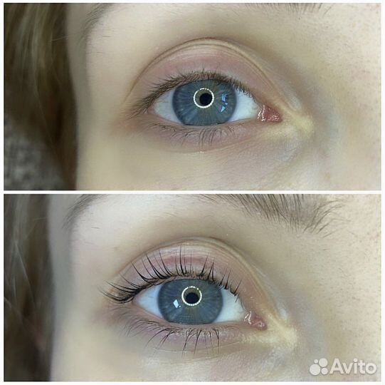 Стрейчинг ресниц