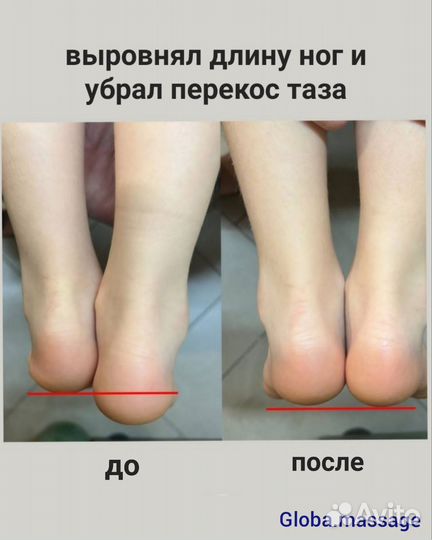 Массаж Лечебный