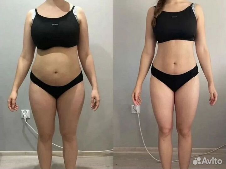 Эндосфера массаж -худеем с первого сеанса