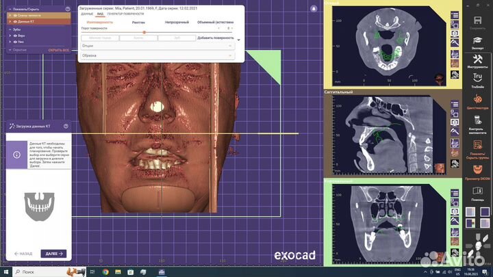 Exoplan Rijeka 3.1 v8587 (2023-07-06 )