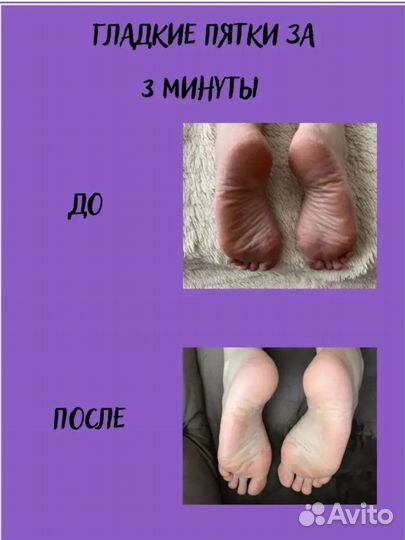 Жидкая пемза кератолик