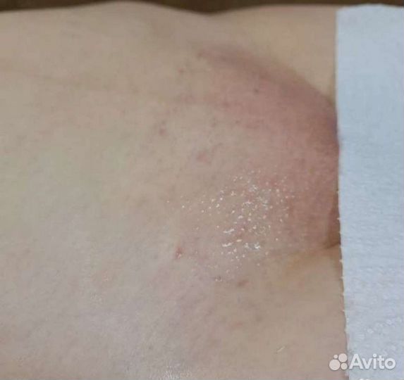 Спа шугаринг