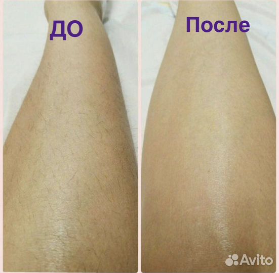 Шугаринг сахар/воск