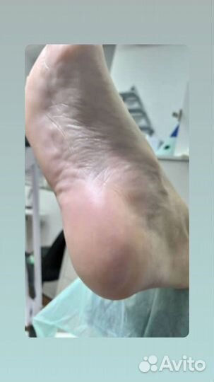 Педикюр с выездом на дом