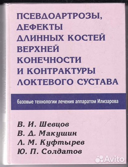 Псевдоартрозы, дефекты длинных костей верхней коне
